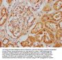 CLCF1 Antibody