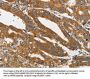 PIK3C3 Antibody