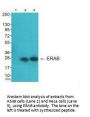 HSD17B10 Antibody