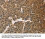 TNFRSF10D Antibody