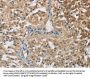 TNFRSF10D Antibody