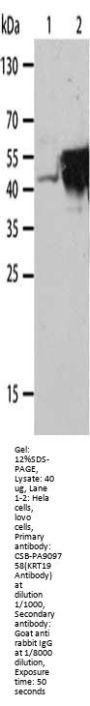 KRT19 Antibody
