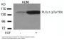 Phospho-PLCG1 (Tyr783) Antibody