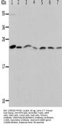 PRDX1 Antibody