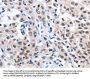 SUMO1 Antibody