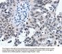 SUMO1 Antibody