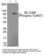 Phospho-CD22 (Tyr807) Antibody