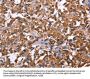 NOS2 Antibody