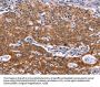 NOS2 Antibody