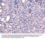 Rabbit anti-human SRPK3 polyclonal antibody