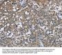 PTK2B Antibody
