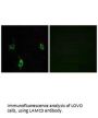 LAMC3 Antibody