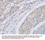 ABLIM1 Antibody