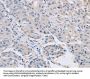 ABLIM1 Antibody