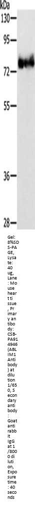 ABLIM1 Antibody