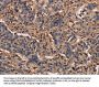 MAP1LC3C Antibody