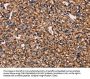MAP1LC3C Antibody