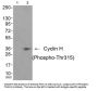 Phospho-CCNH (Thr315) Antibody