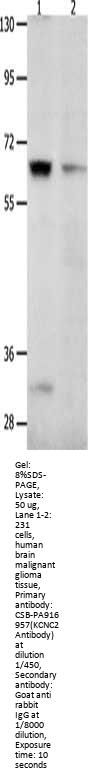 KCNC2 Antibody