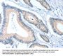 Rabbit anti-human ACTL7B polyclonal antibody