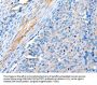 ACTRT1 Antibody