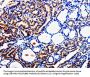 TUBB3 Antibody