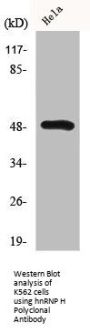 HNRNPH1/HNRNPH2 Antibody