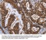 LTA4H Antibody