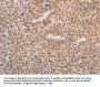 AASDHPPT Antibody