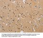 DCTN5 Antibody