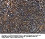 PLIN2 Antibody