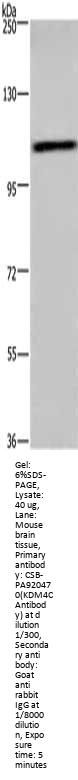 KDM4C Antibody