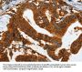 Rabbit anti-human IL20RA polyclonal antibody