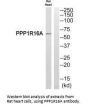 PPP1R16A Antibody