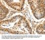 SSB Antibody