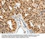 SSB Antibody