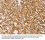 ATG4D Antibody