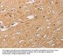 ATG4D Antibody