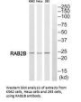 RAB2B Antibody