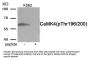 Phospho-CAMK4 (Thr196/200) Antibody