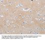 MME Antibody