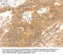 TMEFF2 Antibody