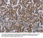 HMGCR Antibody