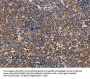 Rabbit anti-human ALG9 polyclonal antibody
