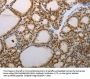 S100A1 Antibody