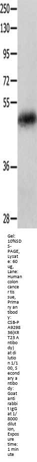 KRT23 Antibody