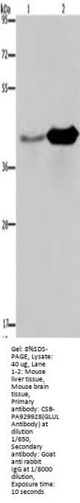 GLUL Antibody