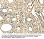 TTBK2 Antibody