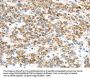 TTBK2 Antibody