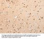 VPS16 Antibody